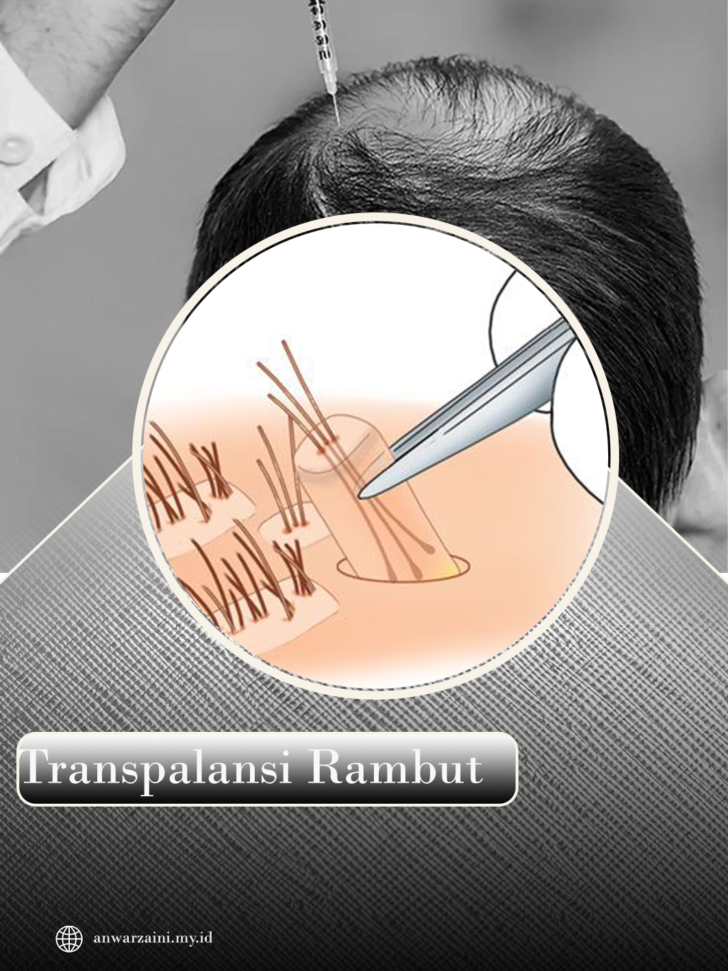 transparansi rambut